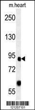 Anti-FOXP2 Rabbit Polyclonal Antibody (PE (Phycoerythrin))