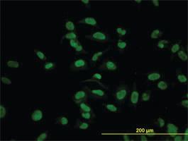 Anti-CMAS Mouse Monoclonal Antibody [clone: 5A2]