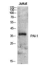 Antibody anti-PAI-1 100 µg