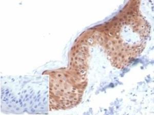 Immunohistochemical analysis of formalin-fixed, paraffin-embedded human skin tissue using Anti-Maspin Antibody [SERPINB5/4972]. Inset: PBS instead of the primary antibody. Secondary antibody negative control.