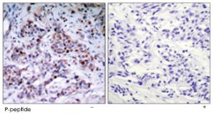 Anti-RELA Rabbit Polyclonal Antibody