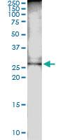 Anti-DCUN1D1 Rabbit Polyclonal Antibody