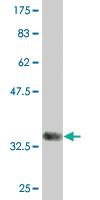 Anti-ITGB1BP2 Mouse Monoclonal Antibody [clone: 3G9]