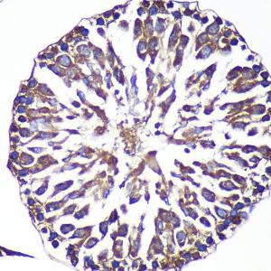 Immunohistochemistry analysis of paraffin-embedded rat testis using Anti-ANKLE2 Antibody (A305517) at a dilution of 1:100 (40x lens)