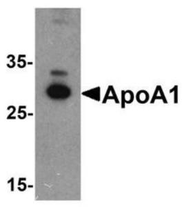 Anti-LDL Receptor Rabbit Polyclonal Antibody