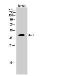 Antibody anti-PAI-1 100 µg