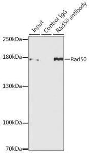 Immunoprecipitation analysis of 150µg extracts of MCF7 cells using 3µg of Anti-Rad50 Antibody (A11606). This Western blot was performed on the immunoprecipitate using Anti-Rad50 Antibody (A11606) at a dilution of 1:500.