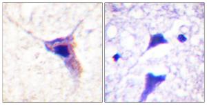 Immunohistochemical analysis of paraffin-embedded human brain using Anti-Synapsin1 (phospho Ser62) Antibody. The right hand panel represents a negative control, where the antibody was pre-incubated with the immunising peptide