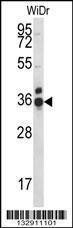 Anti-CCDC90B Rabbit Polyclonal Antibody (PE (Phycoerythrin))