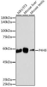 Western blot analysis of extracts of various cell lines, using Anti-P4HB Antibody [ARC2398] (A306427) at 1:1,000 dilution The secondary antibody was Goat Anti-Rabbit IgG H&L Antibody (HRP) at 1:10,000 dilution Lysates/proteins were present at 25 µg per lane