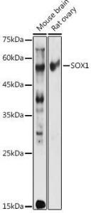 Western blot analysis of extracts of various cell lines, using Anti-SOX1 Antibody (A11607) at 1:1,000 dilution. The secondary antibody was Goat Anti-Rabbit IgG H&L Antibody (HRP) at 1:10,000 dilution.