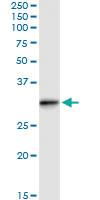 Anti-RABL2B Polyclonal Antibody Pair