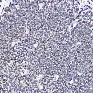 Immunohistochemistry analysis of paraffin-embedded mouse embryos using Anti-SOX1 Antibody (A11607) at a dilution of 1:20 (40x lens). Perform high pressure antigen retrieval with 10 mM citrate buffer pH 6.0 before commencing with IHC staining protocol.