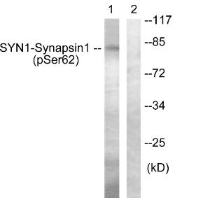 Western blot analysis of lysates from HeLa cells treated with Anisomycin 25ug/ml 30' using Anti-Synapsin1 (phospho Ser62) Antibody. The right hand lane represents a negative control, where the antibody is blocked by the immunising peptide