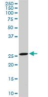 Anti-DCUN1D1 Mouse Monoclonal Antibody [clone: 3D7]