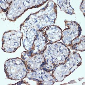 Immunohistochemistry analysis of paraffin-embedded human placenta using Anti-P4HB Antibody [ARC2398] (A306427) at a dilution of 1:100 (40x lens) Perform microwave antigen retrieval with 10 mM Tris/EDTA buffer pH 90 before commencing with IHC staining protocol