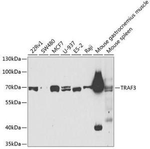 Western blot analysis of extracts of various cell lines, using Anti-TRAF3 Antibody (A11608) at 1:400 dilution. The secondary Antibody was Goat Anti-Rabbit IgG H&L Antibody (HRP) at 1:10000 dilution. Lysates/proteins were present at 25 µg per lane