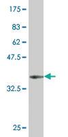 Anti-AATF Mouse Monoclonal Antibody [clone: 3C7]