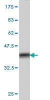 Anti-MMP26 Mouse Monoclonal Antibody [clone: 6C6]