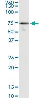 Anti-G3BP1 Antibody Pair