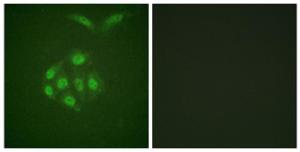 Immunofluorescence analysis of A549 cells using Anti-Survivin (phospho Thr117) Antibody. The right hand panel represents a negative control, where the antibody was pre-incubated with the immunising peptide.