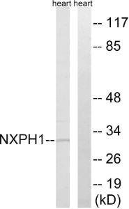 Western blot analysis of lysates from rat heart cells using Anti-NXPH1 Antibody. The right hand lane represents a negative control, where the antibody is blocked by the immunising peptide