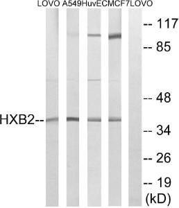 Western blot analysis of lysates from MCF-7, HUVEC, A549, and LOVO cells using Anti-HOXB2 Antibody. The right hand lane represents a negative control, where the antibody is blocked by the immunising peptide