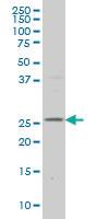 Anti-DCUN1D1 Mouse Monoclonal Antibody [clone: 3D7]