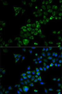 Immunofluorescence analysis of HeLa cells using Anti-TRAF3 Antibody (A11608). DAPI was used to stain the cell nuclei (blue)