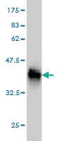 Anti-MTMR2 Mouse Monoclonal Antibody [clone: 4G6]