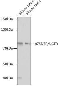 Western blot analysis of extracts of various cell lines, using Anti-p75 NGF Receptor Antibody [ARC0284] (A306428) at 1:1,000 dilution