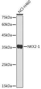 Western blot analysis of extracts of NCI-H460 cells, using Anti-TTF1 Antibody (A11609) at 1:500 dilution The secondary antibody was Goat Anti-Rabbit IgG H&L Antibody (HRP) at 1:10,000 dilution Lysates/proteins were present at 25 µg per lane