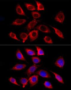 Immunofluorescence analysis of HeLa using Anti-GALC Antibody [ARC58990] (A309371) at a dilution of 1:100 (40x lens). DAPI was used to stain the cell nuclei (blue).