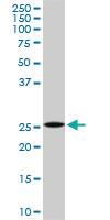 Anti-DCUN1D1 Mouse Monoclonal Antibody [clone: 3D7]