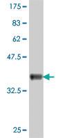 Anti-CRB1 Mouse Polyclonal Antibody