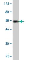 Anti-COL2A1 Mouse Monoclonal Antibody [clone: 1E1]