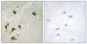 Immunohistochemical analysis of paraffin-embedded human brain using Anti-Survivin (phospho Thr117) Antibody. The right hand panel represents a negative control, where the antibody was pre-incubated with the immunising peptide.