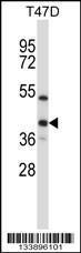 Anti-ERCC1 Rabbit Polyclonal Antibody (APC (Allophycocyanin))