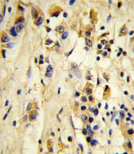 Anti-EIF4E2 Rabbit polyclonal antibody