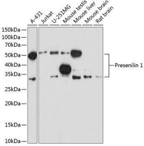 Western blot analysis of extracts of various cell lines, using Anti-Presenilin 1 / PS-1 Antibody [ARC0440] (A307907) at 1:1,000 dilution. The secondary antibody was Goat Anti-Rabbit IgG H&L Antibody (HRP) at 1:10,000 dilution.