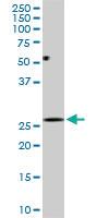 Anti-DCUN1D1 Mouse Monoclonal Antibody [clone: 3D7]