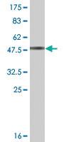 Anti-RGS17 Mouse Monoclonal Antibody [clone: 2H4]