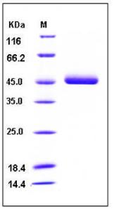 Human recombinant Angiotensin forming enzyme