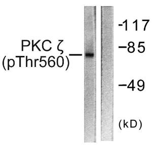 Anti-PKC zeta