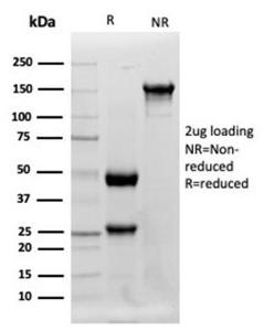 Antibody anti-lysozyme LYZ3942 100 µg