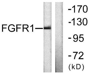 Western blot analysis of lysates from 293 cells using Anti-FGFR1 Antibody. The right hand lane represents a negative control, where the antibody is blocked by the immunising peptide