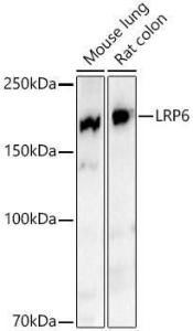 Western blot analysis of various lysates, using Anti-LRP6 Antibody [ARC54062] (A305519) at 1:2,000 dilution