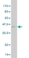 Anti-TSPAN8 Mouse Monoclonal Antibody [clone: 1E5]