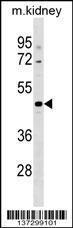 Anti-CCDC91 Rabbit Polyclonal Antibody (HRP (Horseradish Peroxidase))