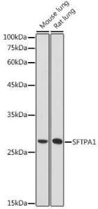 Western blot analysis of extracts of various cell lines, using Anti-Surfactant Protein A / PSAP Antibody (A11614) at 1:1,000 dilution. The secondary antibody was Goat Anti-Rabbit IgG H&L Antibody (HRP) at 1:10,000 dilution.